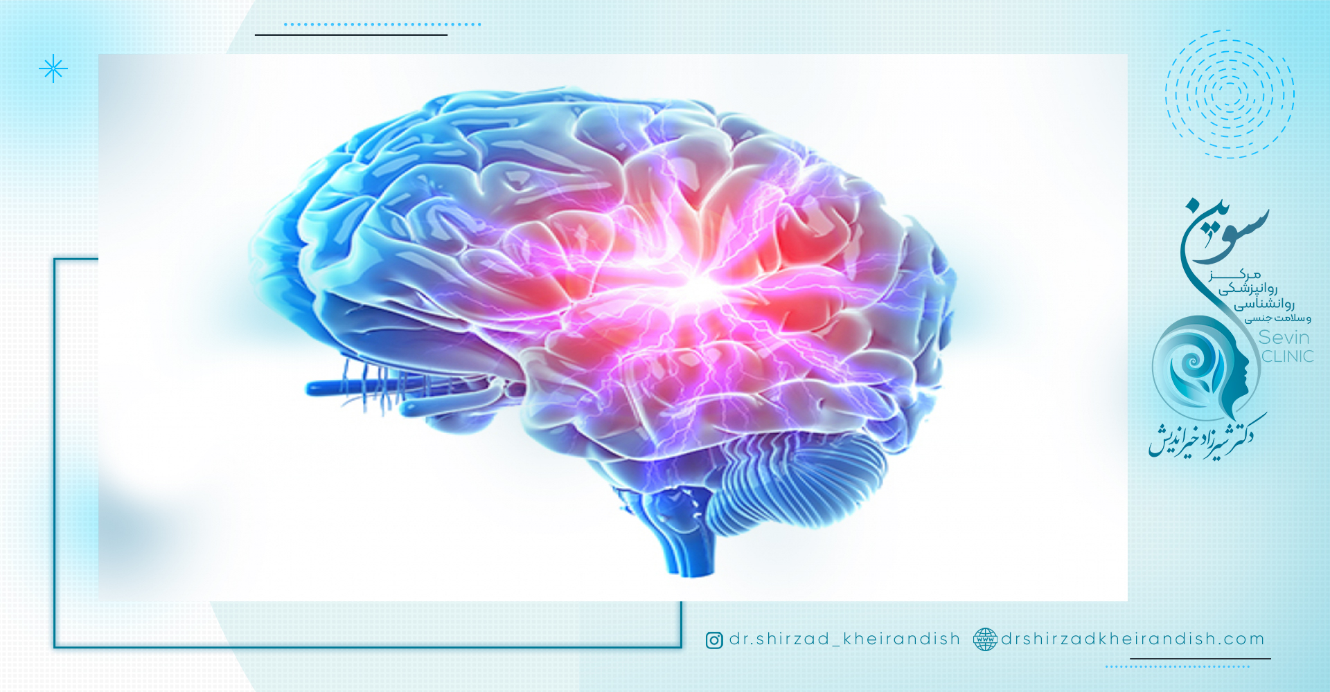 سوالات متداول در مورد درمان اضطراب با tdcs
