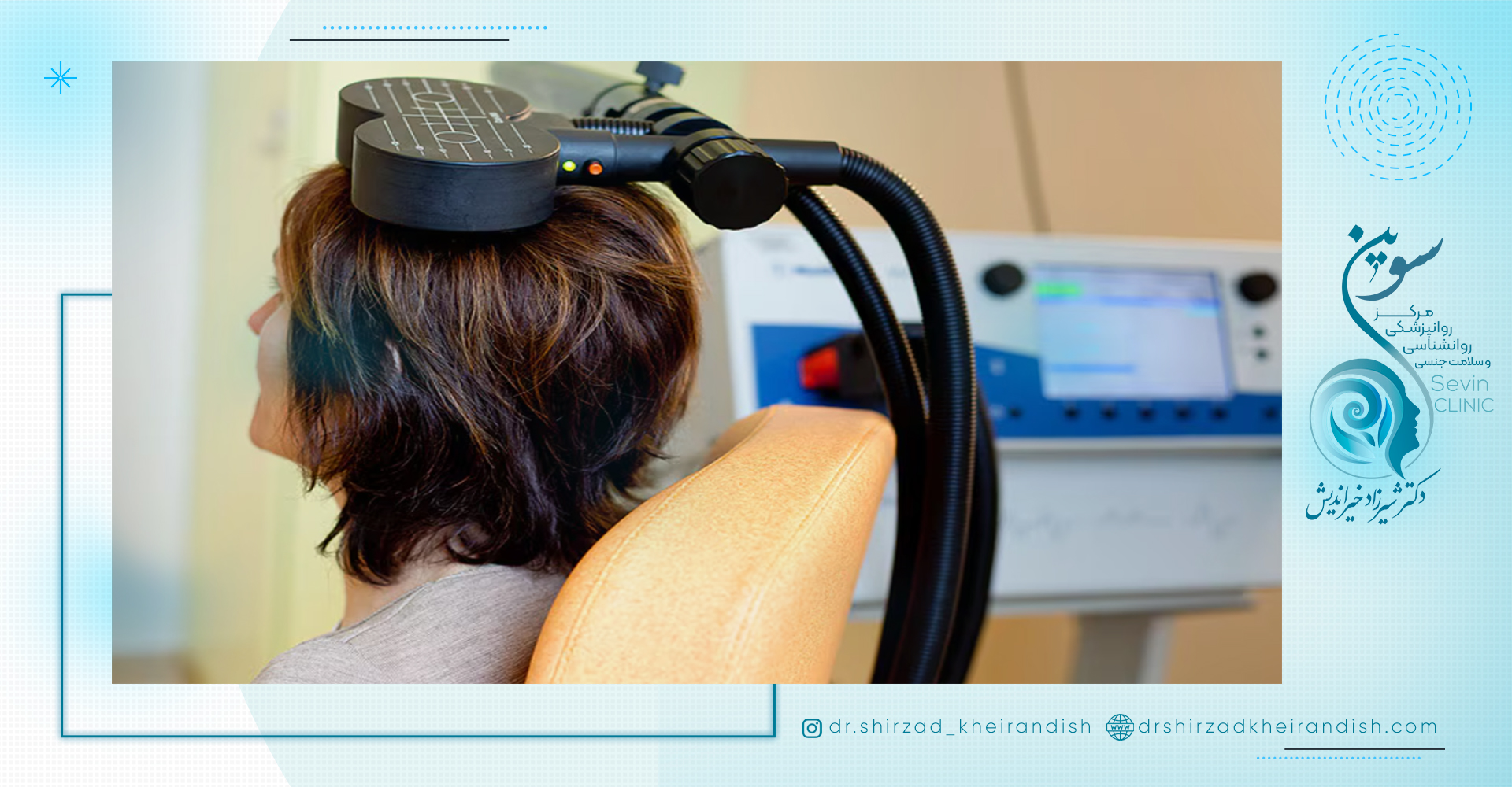 روند درمان وسواس با rtms