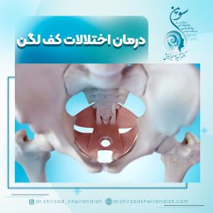 درمان اختلالات کف لگن بانوان